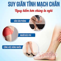 Kem Giãm Tĩnh Mạch Nội Địa Nhật Bản Giảm Đau Nhức Tê Bì Mỏi Chân 50g 2