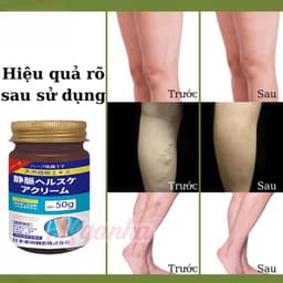 Kem Giãm Tĩnh Mạch Nội Địa Nhật Bản Giảm Đau Nhức Tê Bì Mỏi Chân 50g 5