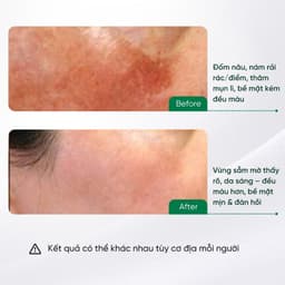 Kem dưỡng GSC Speed Whitening Cream 50g hỗ trợ dưỡng da trắng sáng, làm mờ nám, tàn nhang 3
