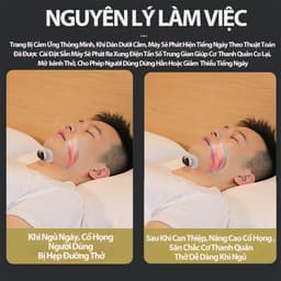 Máy Chống Ngáy Ngủ Thế Hệ 3 – Dán Cằm Xung Nhịp Thông Minh, Giảm Âm Ngáy, Hỗ Trợ Thở Khi Ngủ 8
