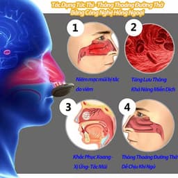 Máy Hỗ Trợ Thông Mũi NASAL SOOTHER– Giảm Nghẹt Mũi, Làm Thoáng Đường Thở Cho Người Viêm Xoang 8