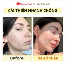 Kem Dưỡng Ẩm Phục Hồi Da Thuần Chay Dr.Althea 345 Relief Cream Prettyskin Hàn Quốc Tuýp 50ml 7